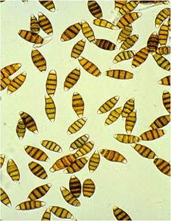 electron micrograph of fungal pathogen