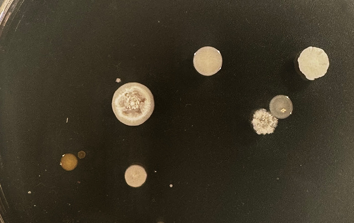 A photo of bacteria colonies on a petri plate.